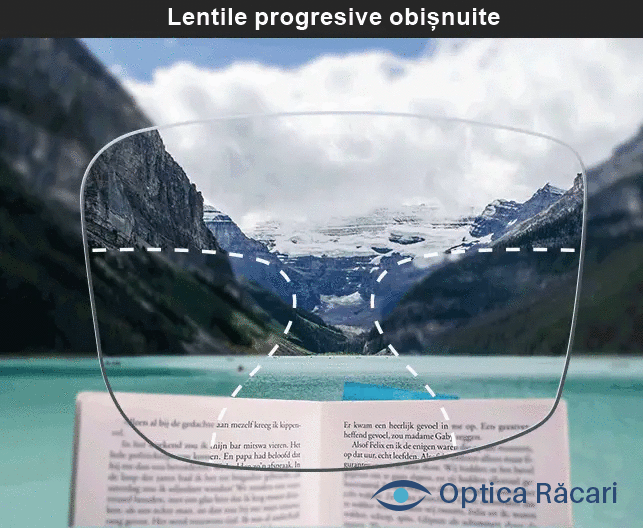 marime zona laterala lentile progresive